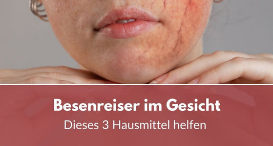Besenreiser im Gesicht