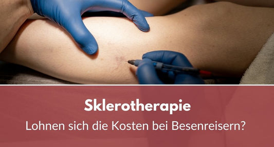 sklerotherapie