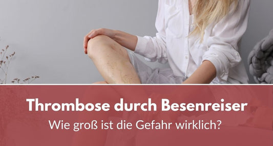 Thrombose durch Besenreiser