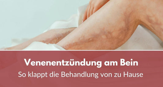 Venenentzündung Bein